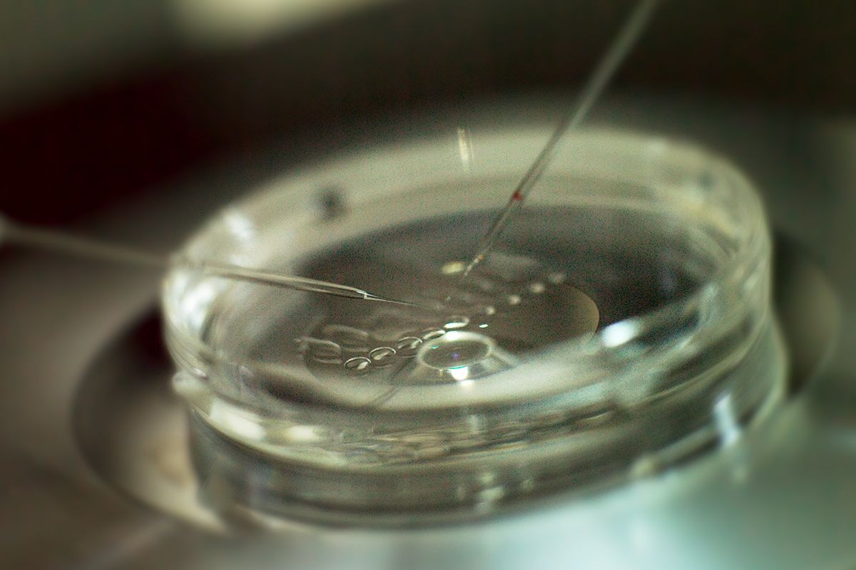 In Vitro Fertilization
